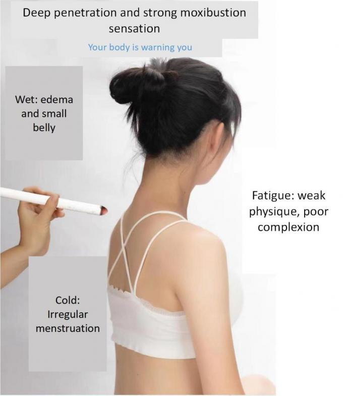 Ai Tiao Chinese Medical Moxibustion Sticks Chen′ S Moxa Sticks Moxa Rolls