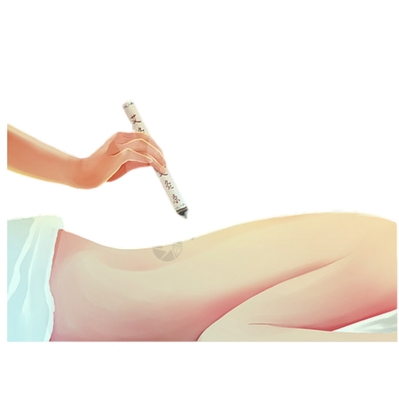 Long Shelf Life Moxibustion Stick senza fumo per la terapia della medicina tradizionale cinese